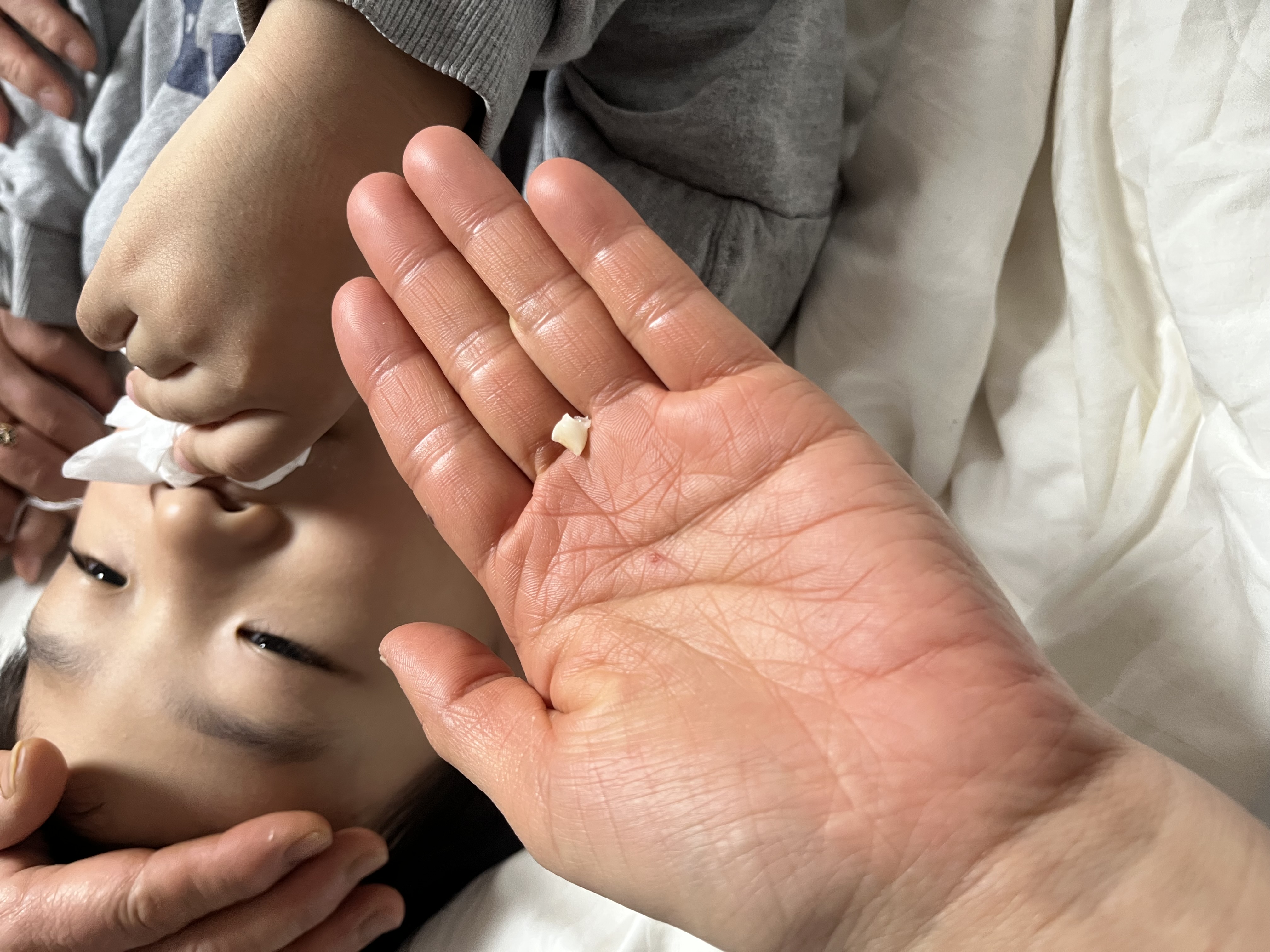 앞니 어디갔지;;